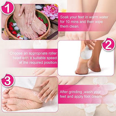 17-in-1 Electric Foot Callus Remover with Vacuum – Rechargeable Pedicure Kit with 3 Grinding Heads & 2 Speeds for Smooth, Soft Feet