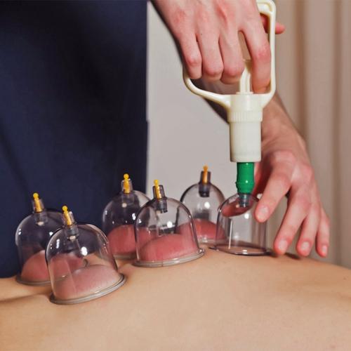 32-Piece Chinese Cupping Therapy Set - Body Vacuum Suction Kit for Acupoint & Deep Tissue Massage Comfort Cosmetic