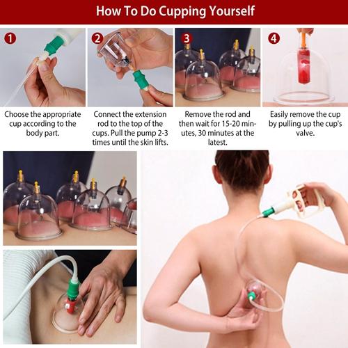 32-Piece Chinese Cupping Therapy Set - Body Vacuum Suction Kit for Acupoint & Deep Tissue Massage Comfort Cosmetic