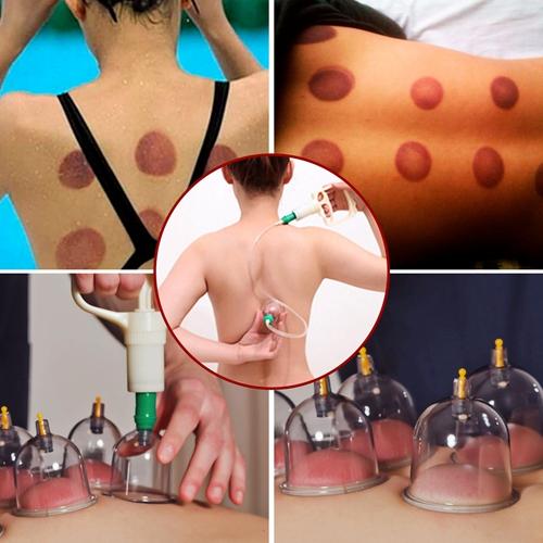 32-Piece Chinese Cupping Therapy Set - Body Vacuum Suction Kit for Acupoint & Deep Tissue Massage Comfort Cosmetic