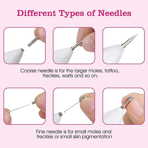 Skin Tag & Mole Remover Pen – LCD Display, 6 Replaceable Needles, USB Rechargeable