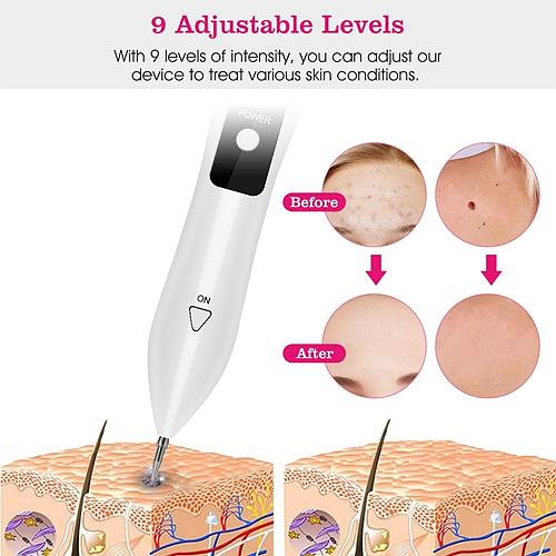 Skin Tag & Mole Remover Pen – LCD Display, 6 Replaceable Needles, USB Rechargeable